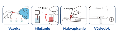 pracovny postup (1)